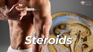 get steroids online Australia